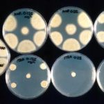 vitro1