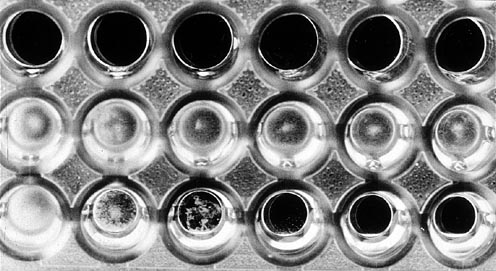 vitro4