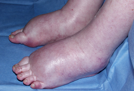 foot