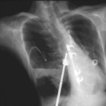 case005