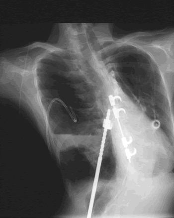 case005