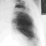 case012
