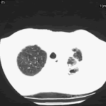 case012