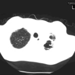 case012