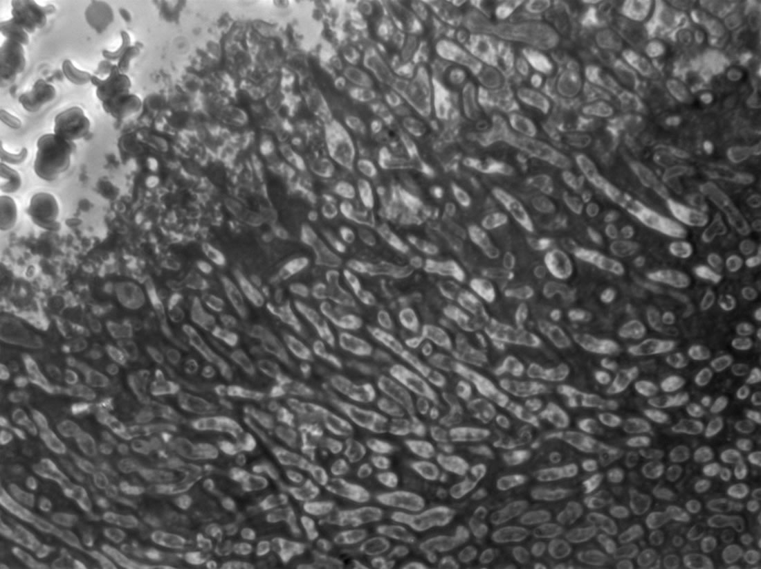 IPA microscopy 2