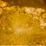 Oxalate crystals in a cavity wall 1