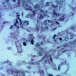 intestinal 4