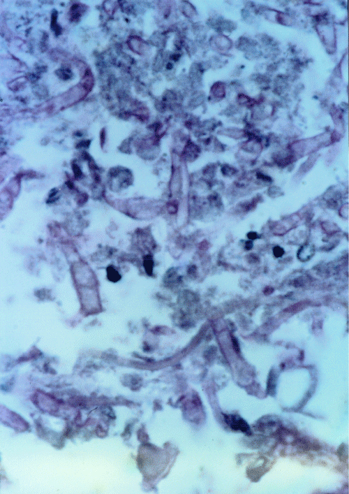 intestinal 4