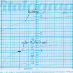 spirometer 1