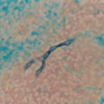 staining of eosinophilic mucin 2