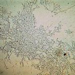 microscopy11
