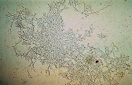 microscopy11