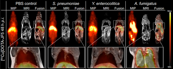 MRI and fused PET/MRI images showing increased uptake of tracer in A. fumigatus-infected lung tissue compared with controls. MRI and fused PET/MRI images showing increased uptake of tracer in A. fumigatus-infected lung tissue compared with controls.