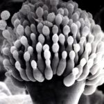 Conidial head (SEM)