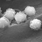Mature conidia (SEM)