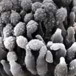 Part of conidial head (SEM)