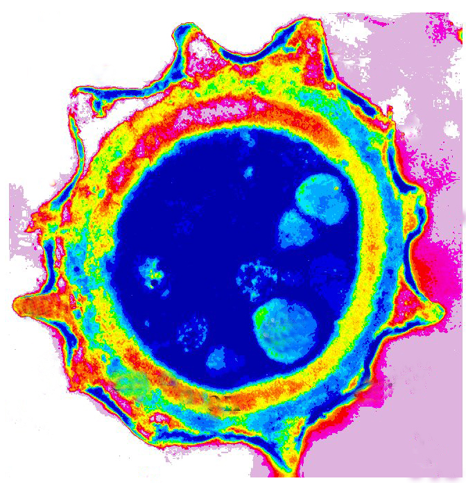 A niger mature conidium TEM in vitro (РКПГF-1124)