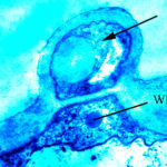 A terreus aleurospore TEM in vitro (РКПГF-1275)