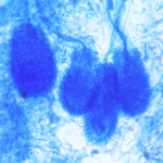 A. clavatus