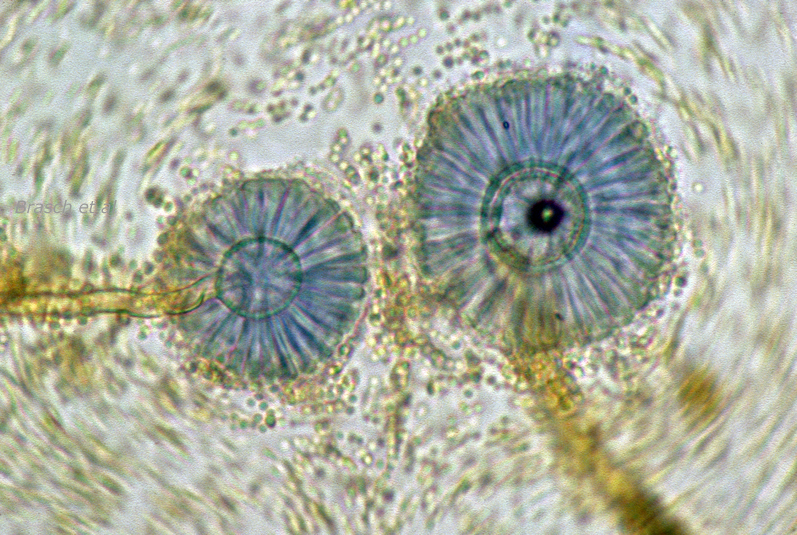 Image C. Aspergillus ochraceopetaliformis conidial heads 