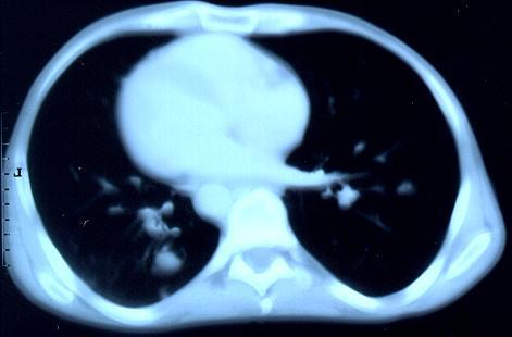 Image C.