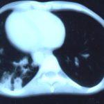 Image B.