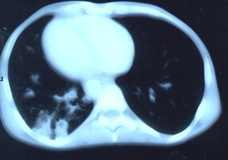 Image B.