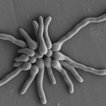 Germinating spores of Aspergillus fumigatus