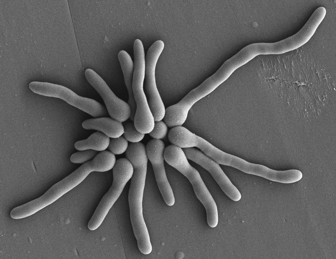 Germinating spores of Aspergillus fumigatus