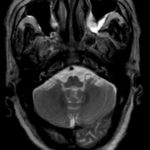 Image B