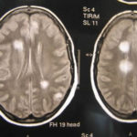 Image D