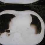 Image J