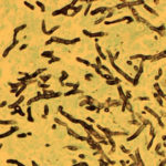 Image H. Histology stained with GMS stain showing septate branching hyphae