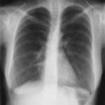 Image G. 05/01 Complete resolution of abnormality