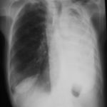 Image C. April 2002 