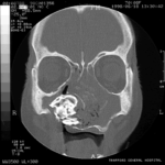 Image C.