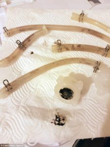 Dirt in tubing & inline filters