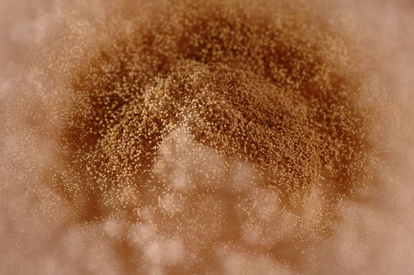Image B. Culture at higher magnification. 