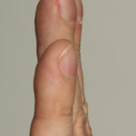 Image C.