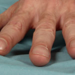 Image B.