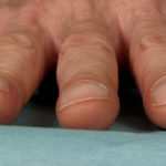 Image A.