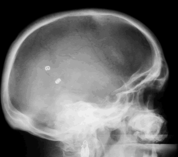 Image B.