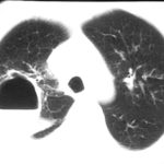 Image F. 3/2000