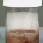 Image B. Blood stained sputum samples from this patient.