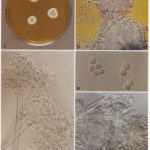 Image 2. A Colonies on MEA after one week; B, C conidial heads with tip of conidiophire, x920; D conidial head, x 2330; E conidial heads x920 