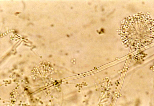 Image 4. A. versicolor by microscopy showing very long thin conidiophores. 
