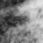 Image 2. Feb 8th Close up of the right lung showing multinodular pattern.