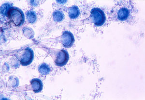 Aspergillus fumigatus