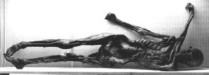 A photograph of the mummified body of the Tyrolean Iceman