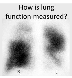 lungfunction